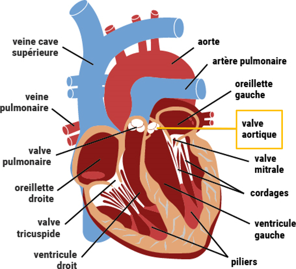 Remplacement valve aortique : Quand faut-il le faire ?